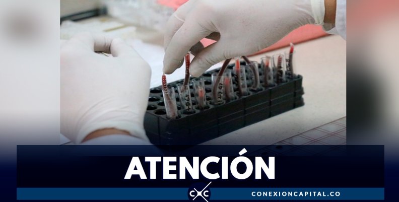 Secretaría de Salud realizó pruebas de VIH y sífilis a trabajadoras sexuales en Bogotá Secretaría de Salud realizó pruebas de VIH y sífilis a trabajadoras sexuales en Bogotá