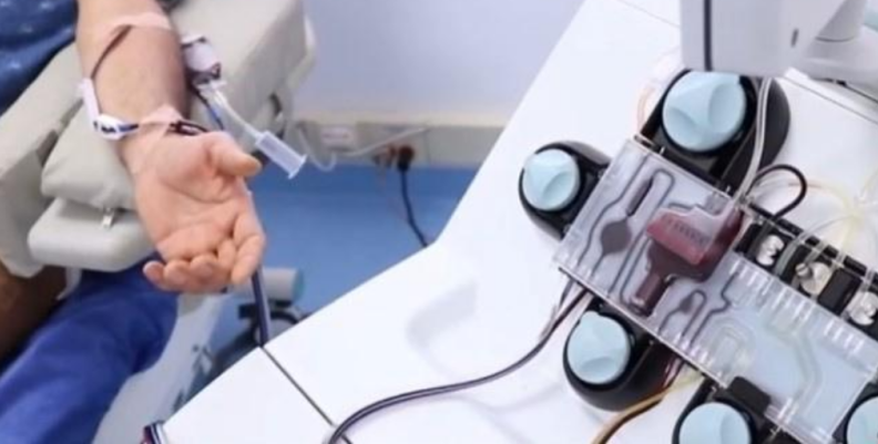 Tratamiento con plasma Tratamiento con plasma