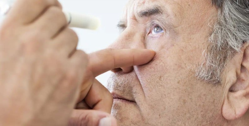 Glaucoma Hombre con el ojo abierto. Van a aplicarle gotas
