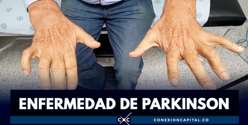 ¿Cuáles son los síntomas de la enfermedad de Párkinson? ¿Cuáles son los síntomas de la enfermedad de Párkinson?