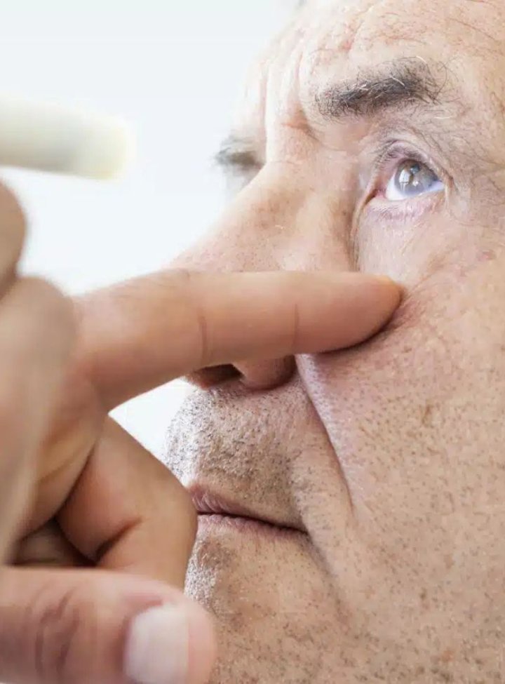 Hombre con el ojo abierto. Van a aplicarle gotas 